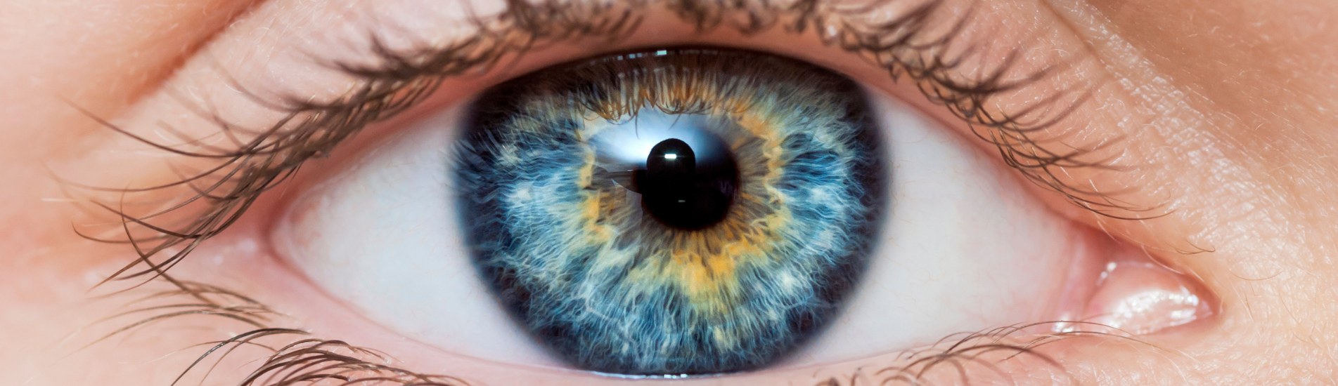 kuidas vältida silmapõletikke